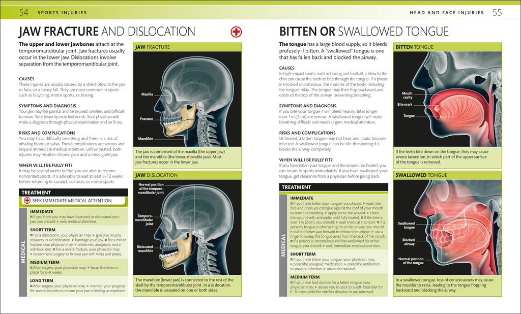 Everyday Sports Injuries