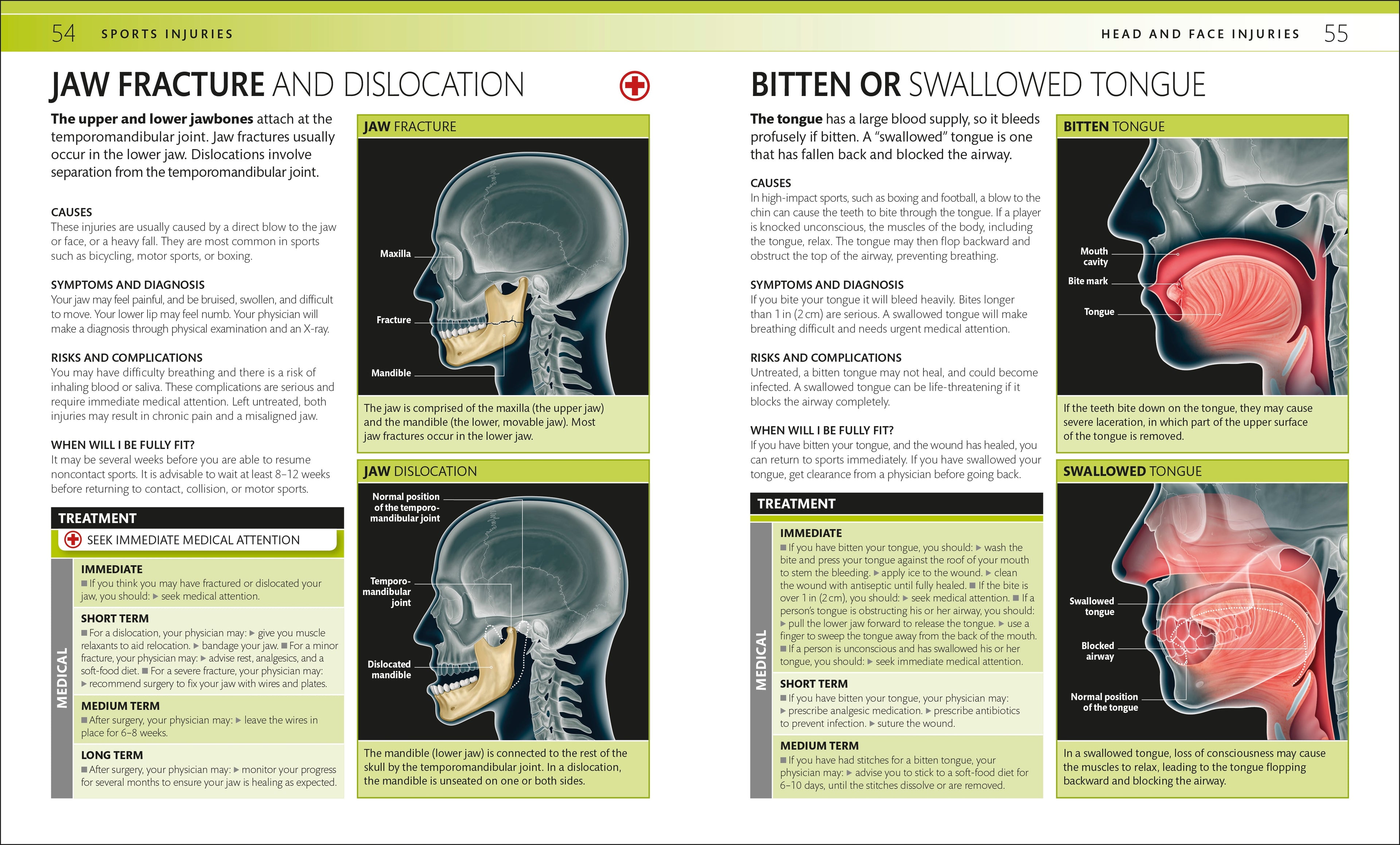 Everyday Sports Injuries